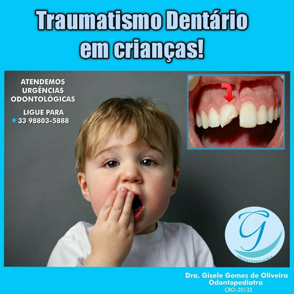 Traumatismo Dentário Em Crianças! - Odontopediatra